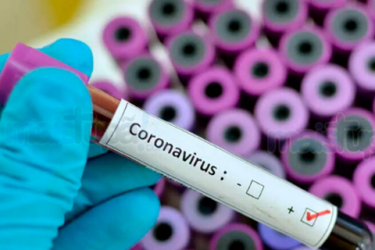 How Coronavirus is Affecting E-Commerce Businesses and How They Can Adapt
