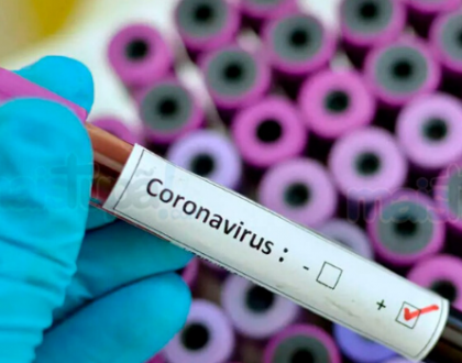 How Coronavirus is Affecting E-Commerce Businesses and How They Can Adapt